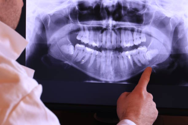 Best Emergency Treatment for Toothache in Dubois, PA